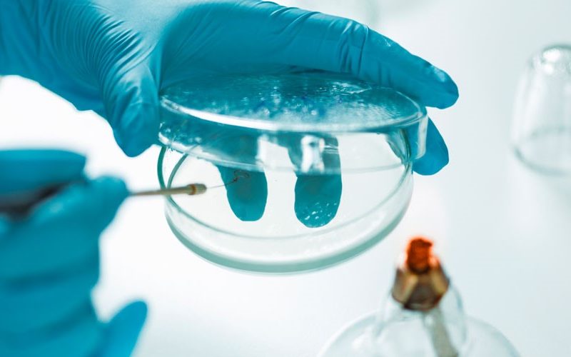 listeriosis-y-la-seguridad-alimentaria