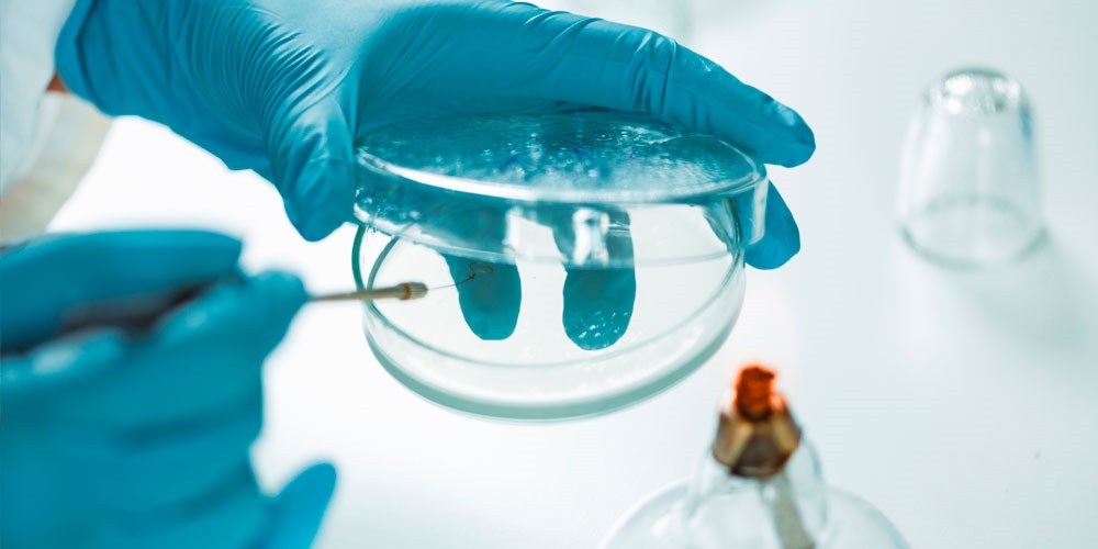 listeriosis-y-la-seguridad-alimentaria